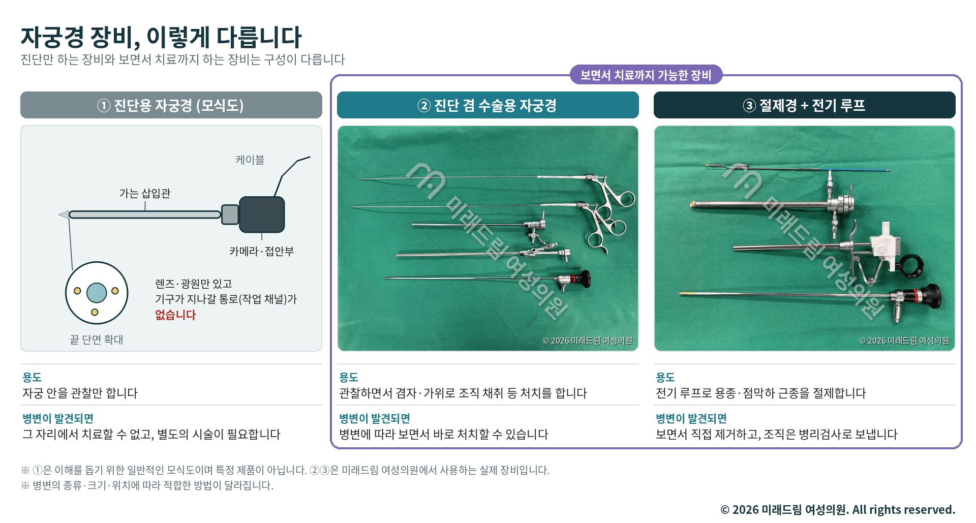 진단용 자궁경 모식도, 진단 겸 수술용 자궁경, 절제경 장비 비교